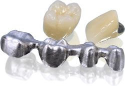 Trường hợp nào nên bọc răng sứ lấy tủy? 