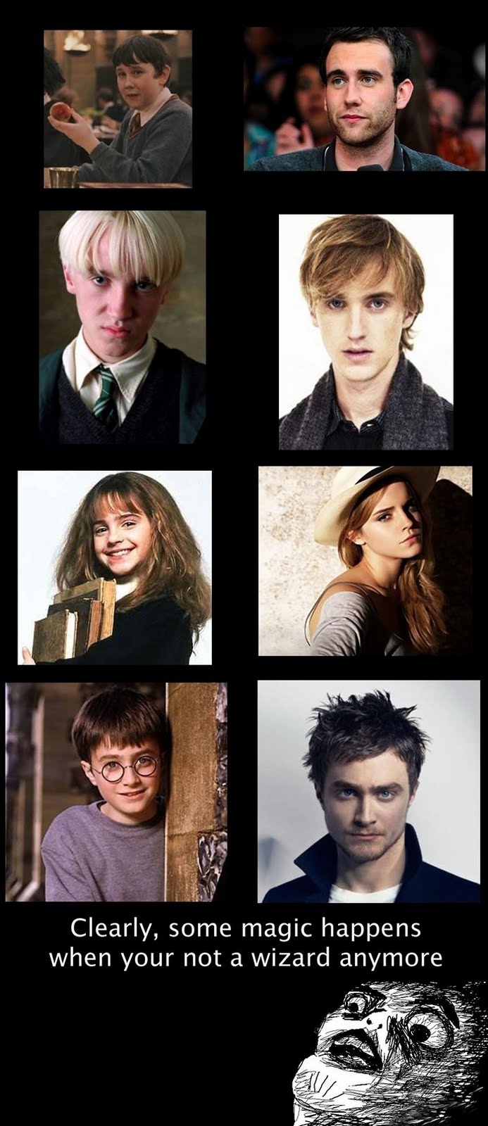 The Cast Of Harry Potter - Then And Now - Clearly, Some Magic Happens When You Are Not A Wizard Anymore