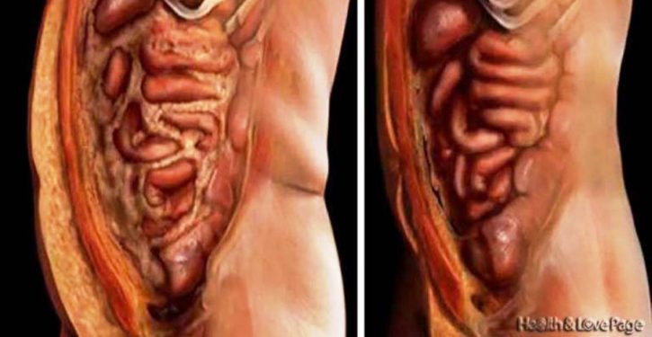 Get Rid Of All The Fat Deposits And Parasites Of Your Body Effortlessly