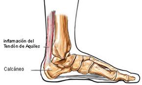 gel hial articular durere dureroasă la genunchi