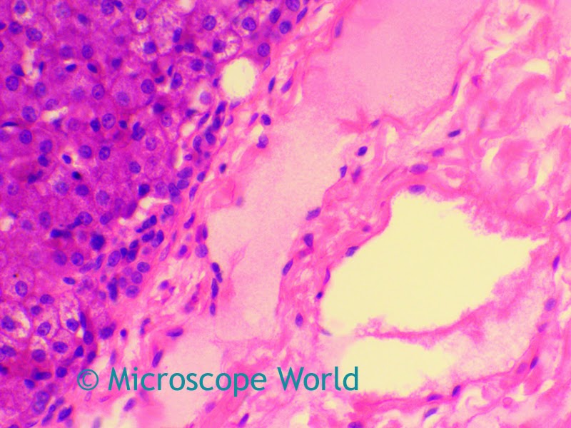 Microscope image of gallbladder captured at 400x magnification.