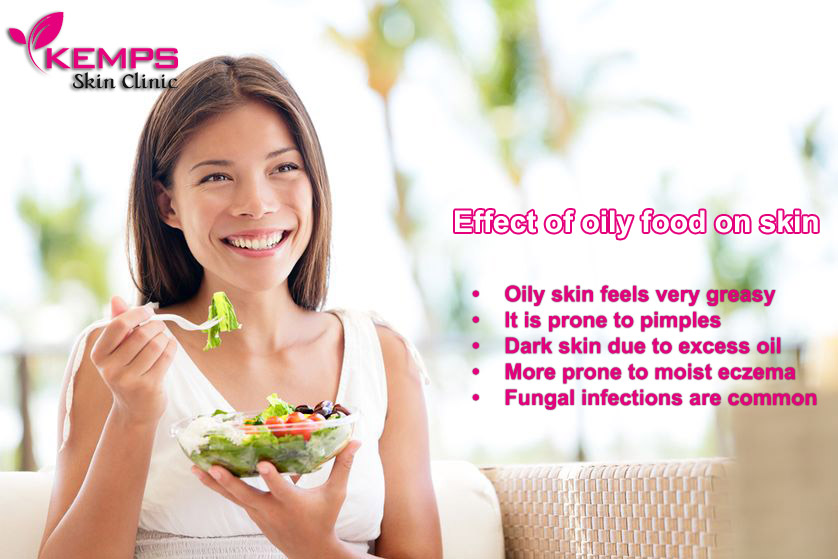 Effect Of Oily Food On Skin Or What Food Causes Pimples On The Face effect-of-oily-food-on-skin-or-what-food-causes-pimples-on-the-face