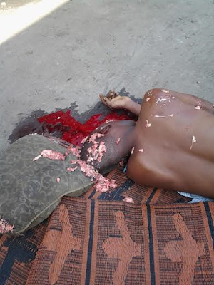 1 Graphic Photos: Fuel Truck crushes the head of a man sleeping under it