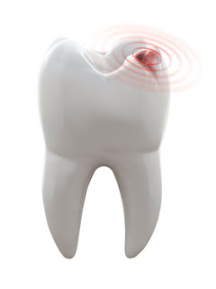 Est-ce que l'allaitement maternel causer des caries?