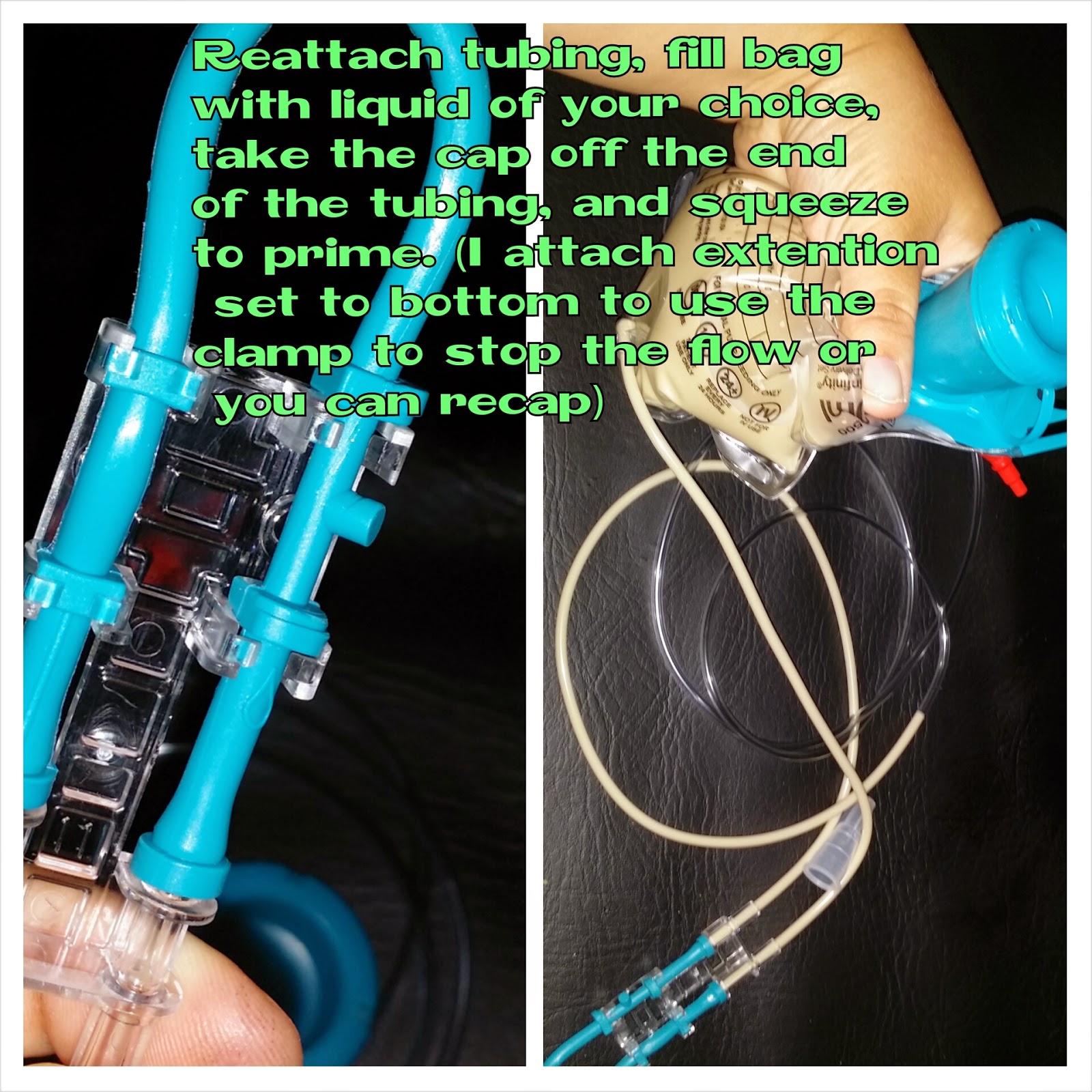 Spastic Quadriplegic Cerebral Palsy How to Convert Zevex Infinity Pump