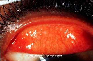 Purulent surgery essays 07 picture