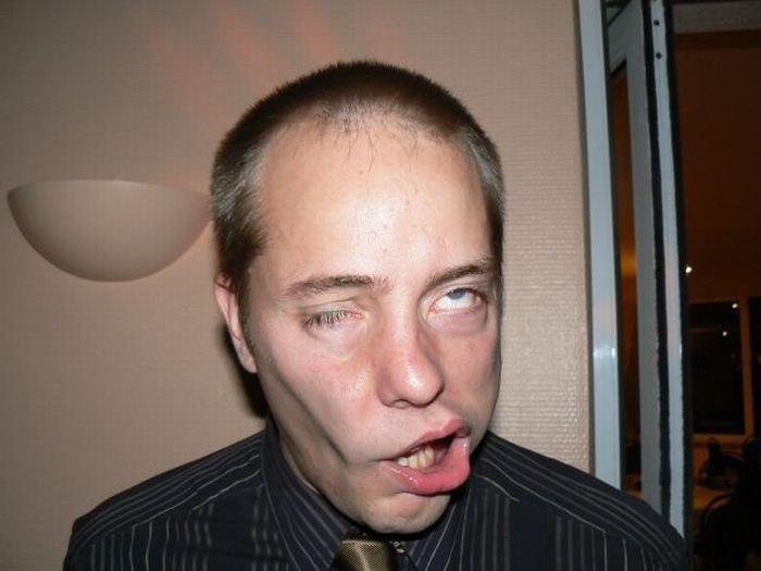 Stressy World Funny Online Ugliest Facial Expression Contest (20 Pics)