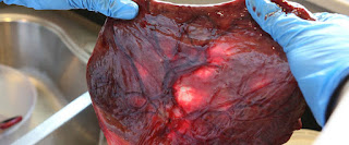 placenta capsules, placenta, placenta pills placenta capsules, placenta, placenta pills