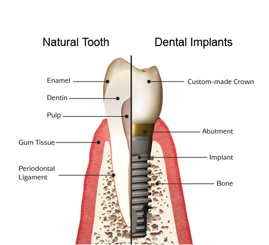 Dr. Tangri's Dental And Orthodontic Centre Root Canal Treatment is