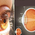 This Ingredient Increases Vision by Upto 97%