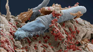 Aracnido Demodex