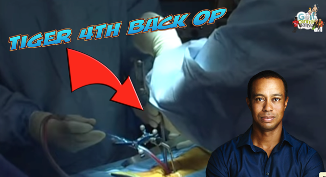 Video Tiger Woods Has Two Vertebrae Fused By New Surgeon In Fourth