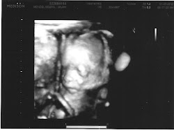 20w5d ultrasound