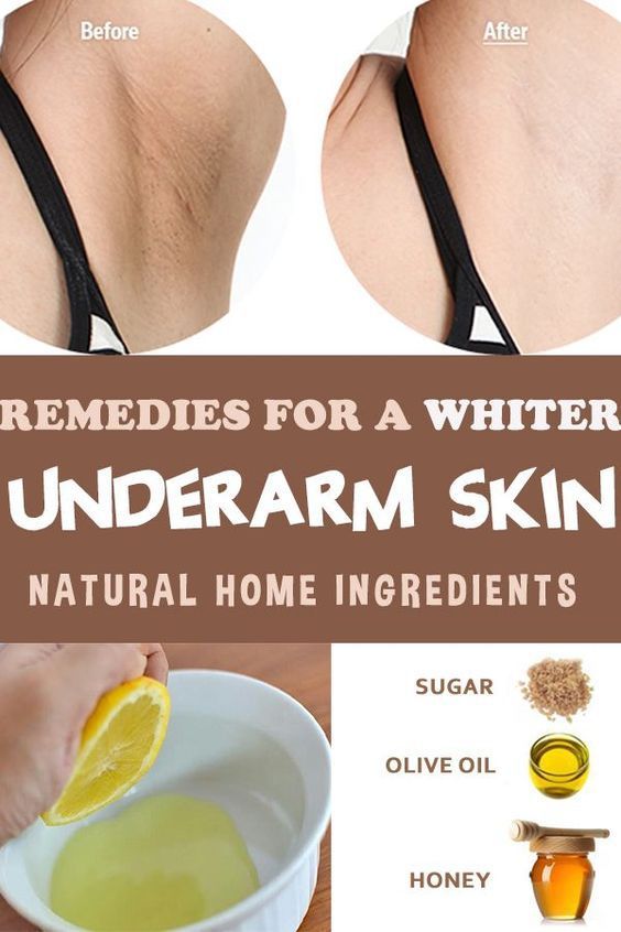 How to Get Rid of Dark Armpits