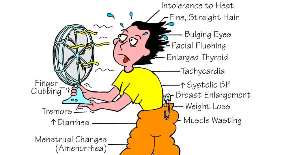 Hyperthyroidism ABC Medicine Hyperthyroidism ABC Medicine