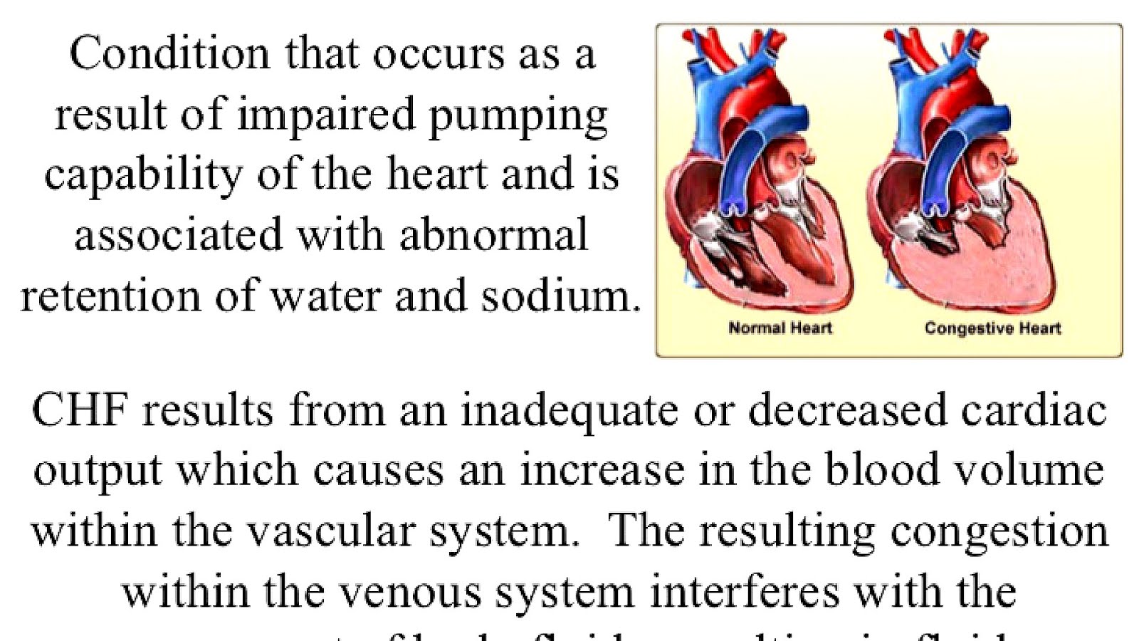 Definition Congestive Heart Failure Hear Choices