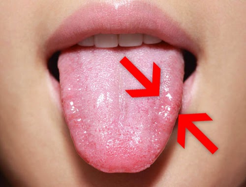 dieta anti candida desayuno