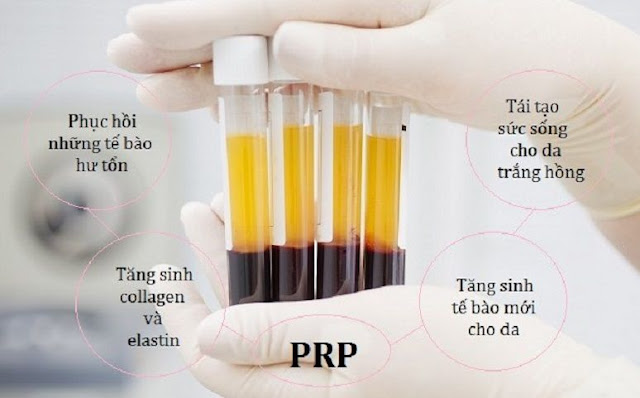cách trẻ hóa làn da bằng PRP