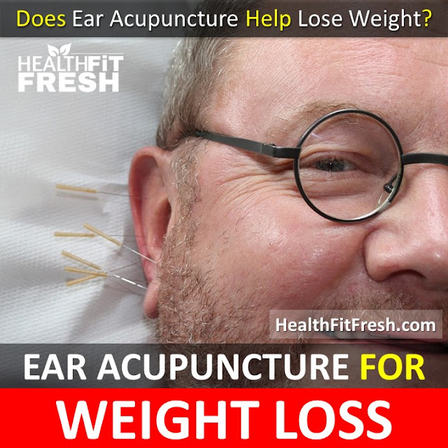 ear acupuncture for weight loss, how to lose weight with ear acupuncture, how to do ear acupuncture, auricular acupuncture weight loss, auriculotherapy for weight loss, ear acupuncture, ear acupuncture weight loss, 