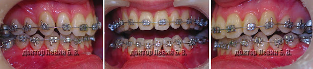 Исправление ошибки неверного позиционирования