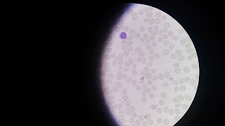 Ilmu Pengetahuan: DIFFERENTIAL COUNT WBC (HITUNG JENIS LEUKOSIT)