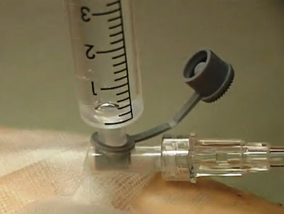 Скорая медицинская помощь: Венозный доступ. Постановка браунюли ...