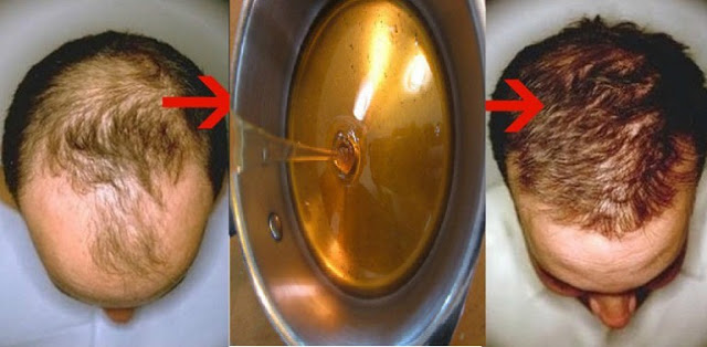 Hair After 35 | hanya orang bodoh yang tidak ingin membaca informasi Hair After 35 | hanya orang bodoh yang tidak ingin membaca informasi