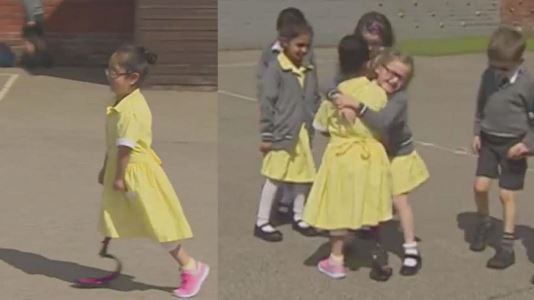 00a A little girl shows off her new prosthetic leg to her friends for the first time and their reaction is heartwarming