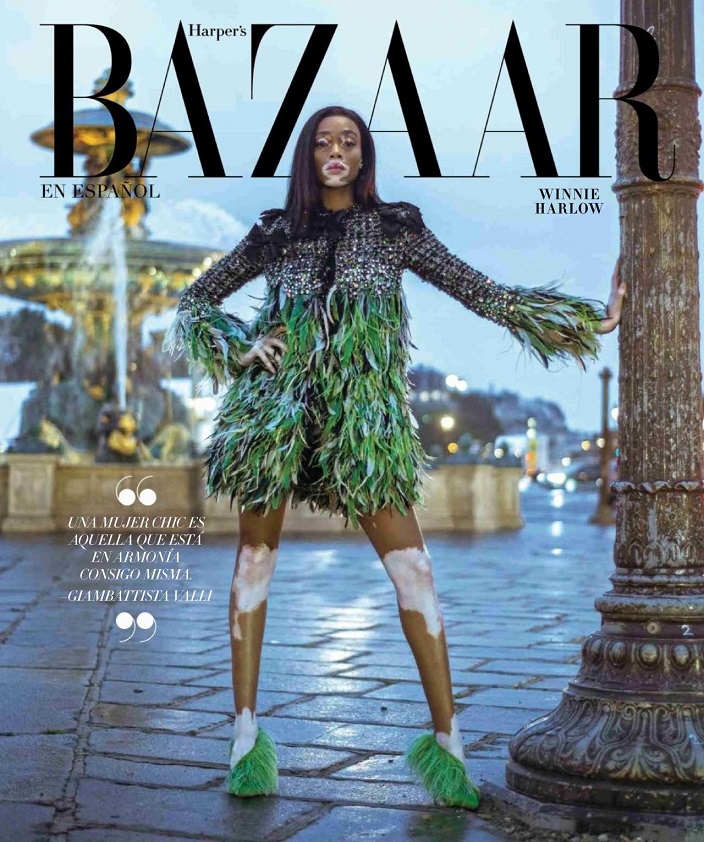 Modaya Dair ♥: Winnie Harlow