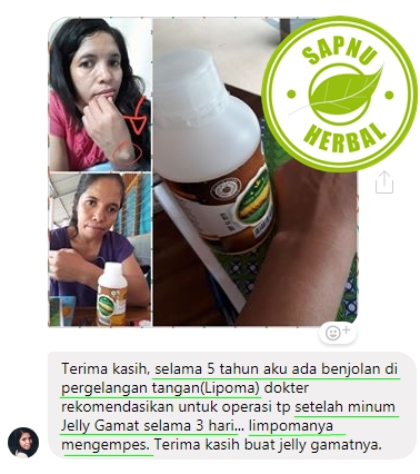 ra Menghilangkan Benjolan Di Selangkangan Kanan Dan Kiri Secara Alami ra Menghilangkan Benjolan Di Selangkangan Kanan Dan Kiri Secara Alami