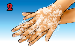 7 Langkah Mencuci Tangan Menurut Depkes Dokter Telapak Kanan Atas