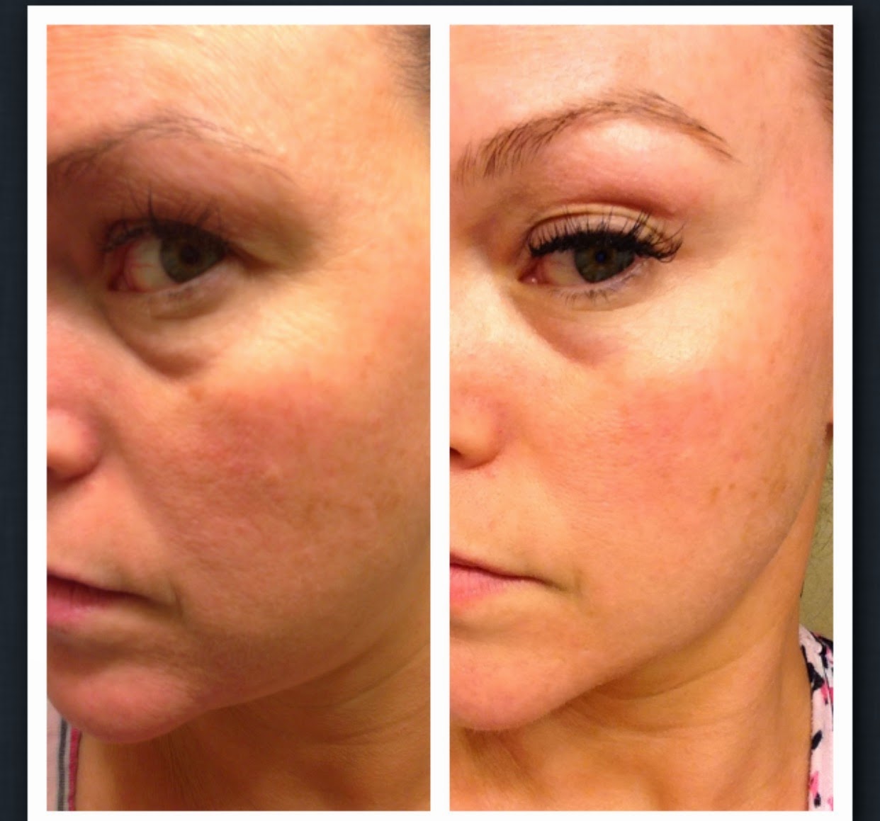 Makeup Artist's Choice Before/After Pics and Testimonials