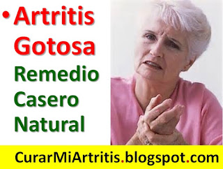 artritis-gotosa-sintomas-remedio-casero-tratamiento-natural