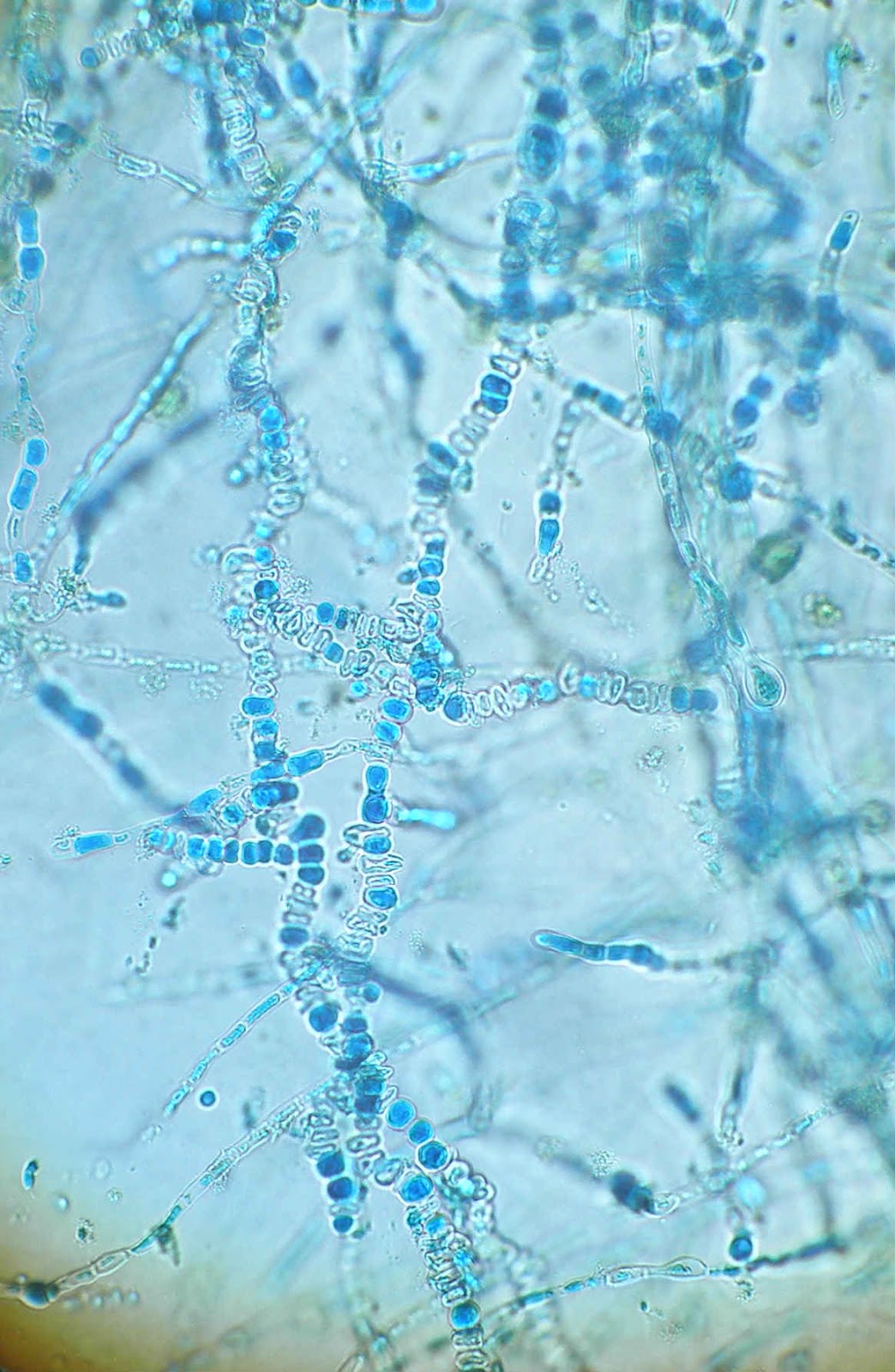 Нити мицелия споры. Микроскопия Trichophyton rubrum. Микроскопия Trichophyton verrucosum. Trichophyton микроскопия.