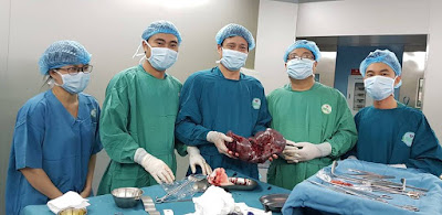 Phẫu thuật cắt lách nặng 3.5 kg