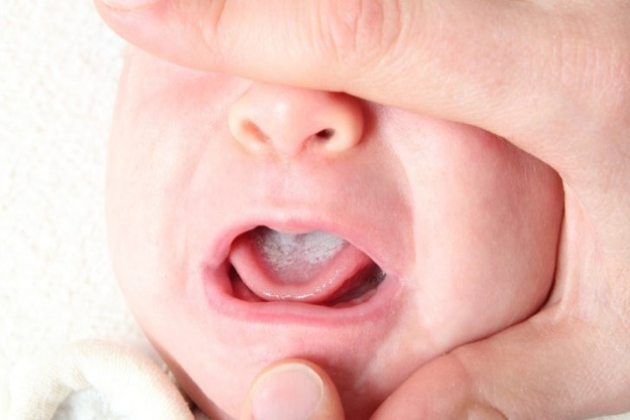 Ternyata Kita Tak Boleh Cium Bibir Bayi yang Belum Tumbuh Gigi, Bisa Timbulkan Kematian