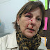 Professora é agredida com socos após repreender aluno