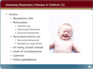 intercostal retractions retraction substernal ards causes newborn recession definition treatment toddler adults