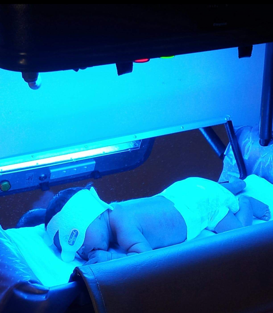 Rawatan Fototerapi Di Rumah Untuk Bayi Kuning