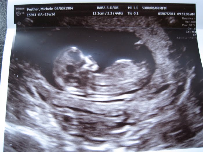 The Prathers 14 Weeks Baby Bump Has Arrived the-prathers-14-weeks-baby-bump-has-arrived