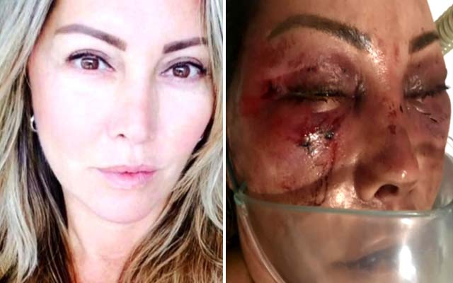 Mulher é espancada por 4h no primeiro encontro com homem que conheceu em rede social