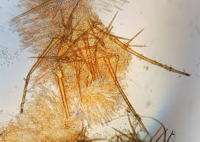 micro of hairs and asci of Cheilymenia stercorea 