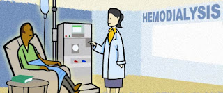 شرح جهاز الغسيل الكلوي - Hemodialysis
