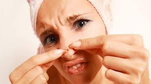 Terbukti 10 Cara Menghilangkan Bintik Hitam Di Hidung Dan Wajah Paling Cepat Dan Ampuh