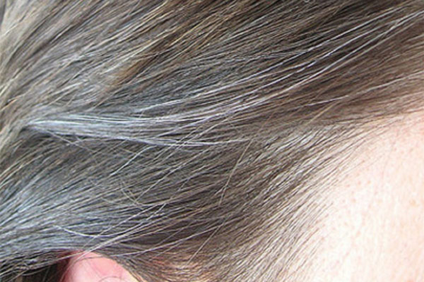 Usdknews Best Ayurvedic Remedies For White Hair And Hair Fall