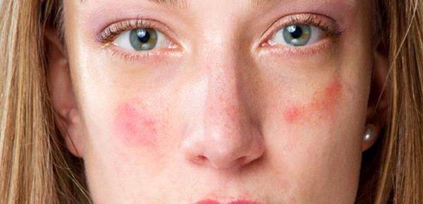 TOP 10:ENFERMEDADES MAS RARAS Y ATERRADORAS | Lo mejor de lo mejor