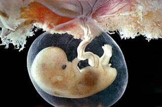 Você Sabe O Que É O Diagnóstico Genético Pré-Implantacional Ou Pgd? 1 embri%c3%a3o