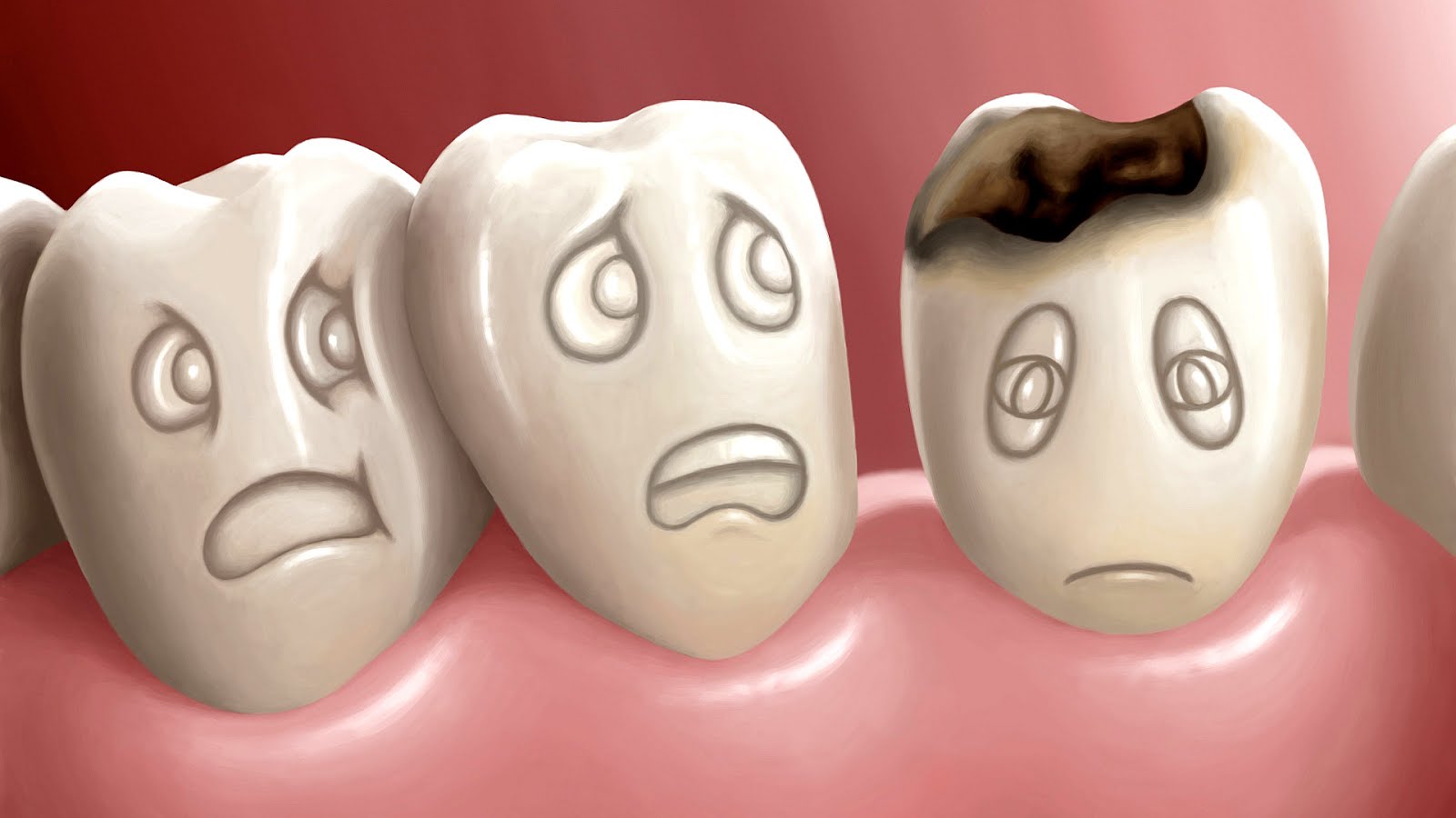 Effects Of Tooth Decay Effect Choices