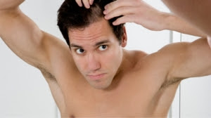 rambut rontok, penyebab rambut rontok, cara mengatasi rambut rontok penyebab rambut rontok pada pria, penyebab rambut rontok pawa wanita