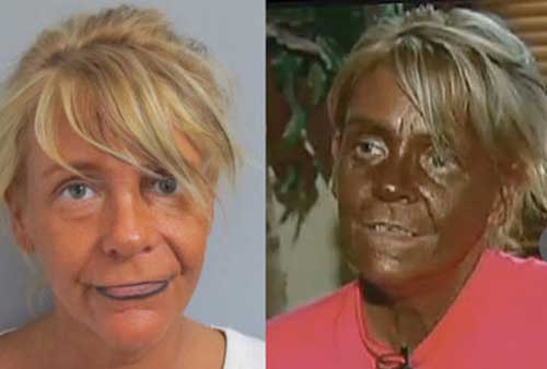 Nothing To Do With Arbroath Mother With Passion For Tanning Accused Of 